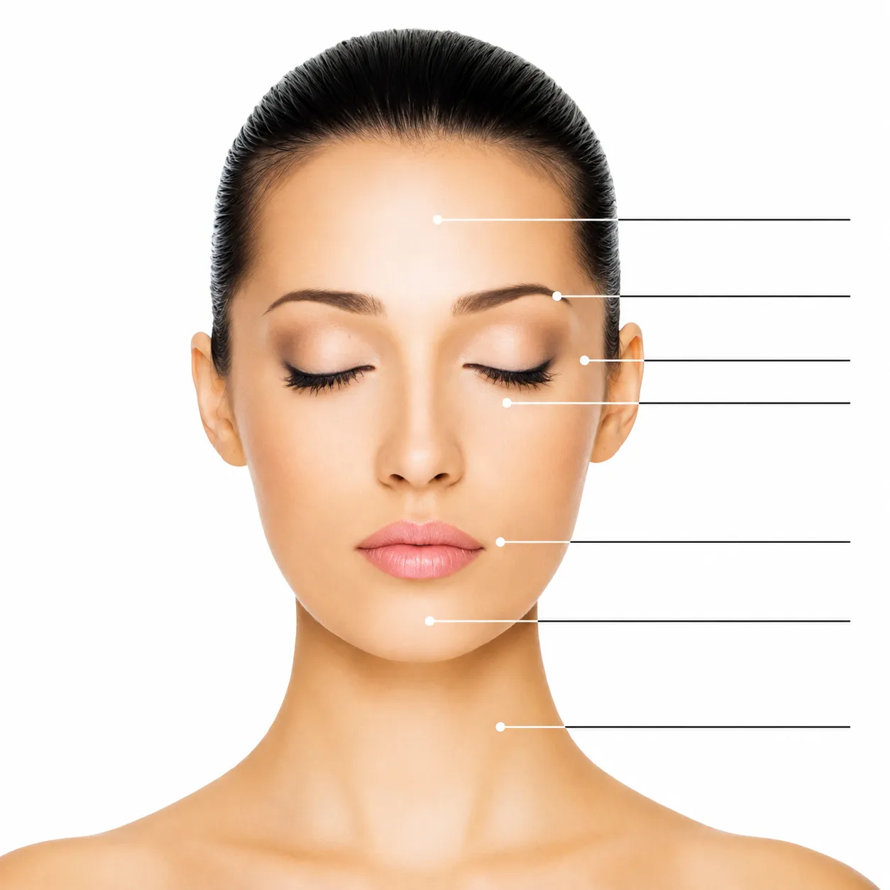 DERMAL FILLER
